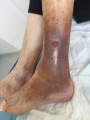 Dermiteocre36.png