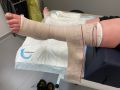 Compression EI22.jpg