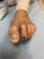 Ongles80.jpg