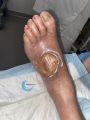 Cou de pied92.jpg