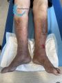 Dermiteocre73.jpg