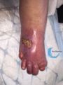 Cou de pied65.jpg