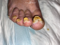 Ongles36.png