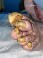Ongles16.png