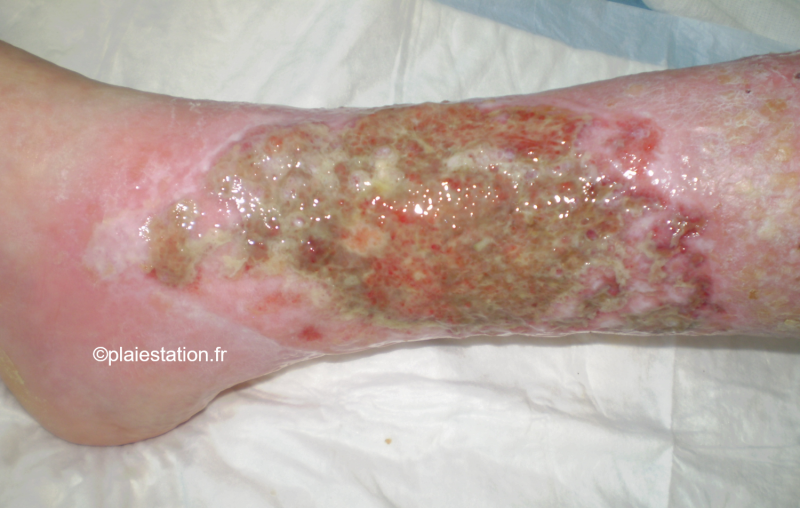 Fichier:Biofilm1.png