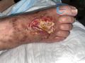 Cou de pied96.jpg