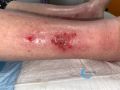 Erosions post bulleuses11.jpg