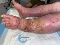 Grosses jambes suintantes48.jpg