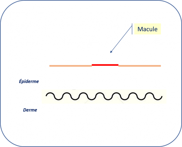 Fichier:Macule.png