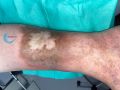 Dermiteocre82.jpg