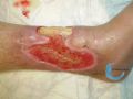 Tendon normal38.jpg