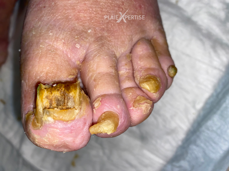 Fichier:Ongles46.png