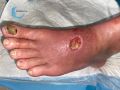 Cou de pied80.jpg