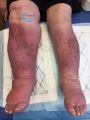 Grosses jambes suintantes28.jpg