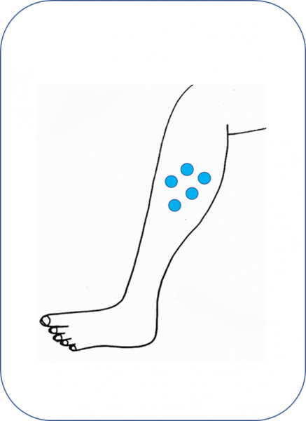 Fichier:Dermatose.png