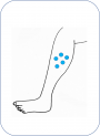 Dermatose.png