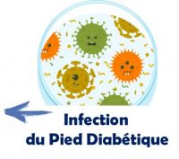 InfectionPD.jpg