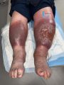 Grosses jambes suintantes36.jpg