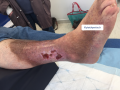 Dermiteocre10.png