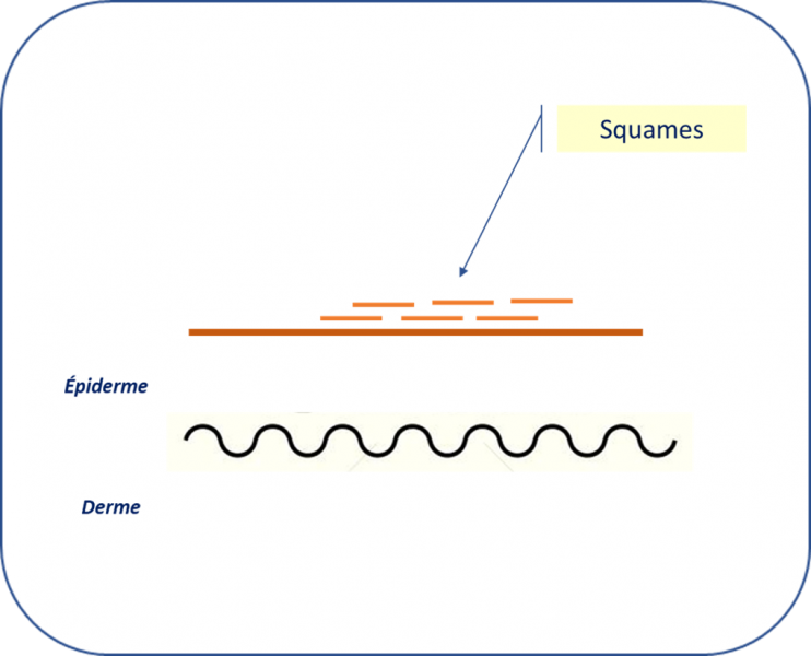 Fichier:Squames.png
