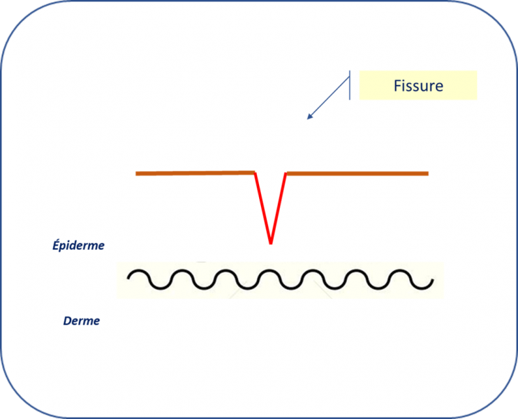 Fichier:Fissure.png