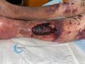 Dermatoporose48.jpg