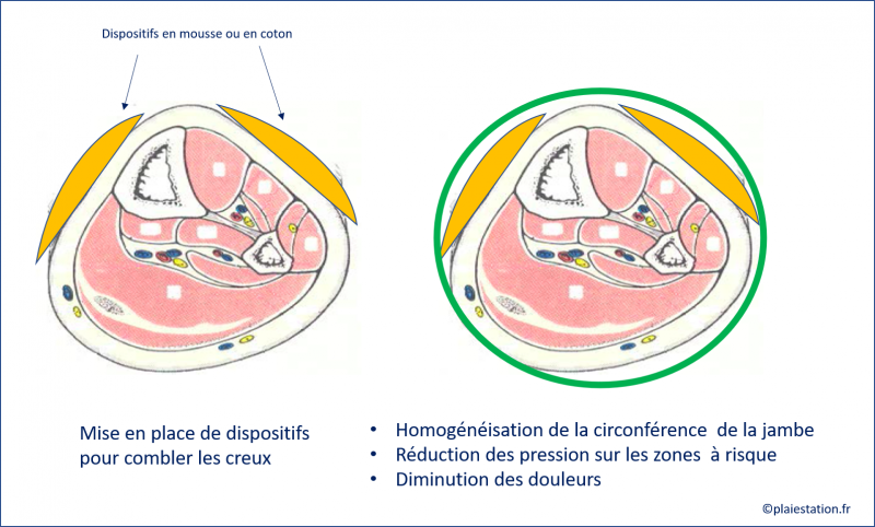 Fichier:Veine19.png