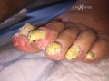 Ongles44.png