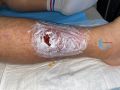 Dermite d'irritation127.jpg