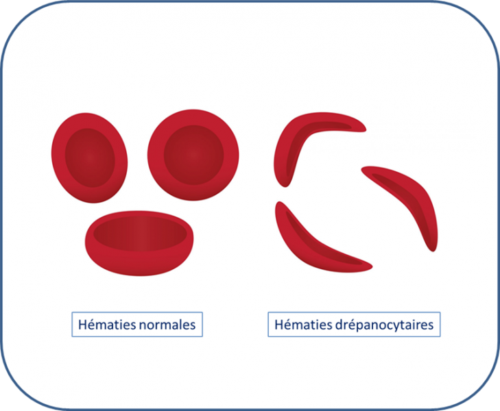 Fichier:Drépano.png