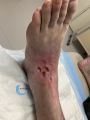 Cou de pied81.jpg