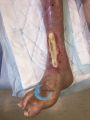Tendon normal30.jpg