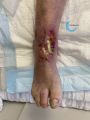 Cou de pied93.jpg