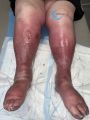 Grosses jambes suintantes39.jpg