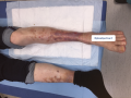 Dermiteocre13.png