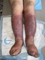 Grosses jambes suintantes54.jpg