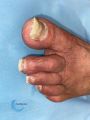 Ongles78.jpg