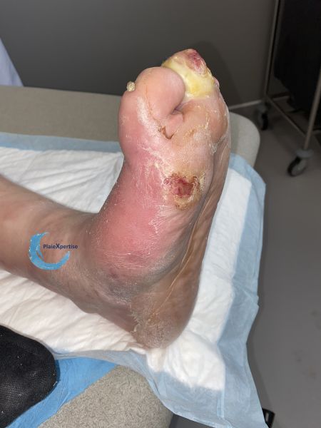 Fichier:Charcot56.jpg