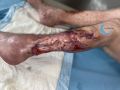 Epidermisation 19.jpg