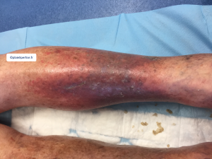 Dermiteocre26.png