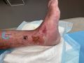 Dermite d'irritation169.jpg