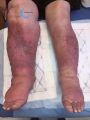 Grosses jambes suintantes29.jpg