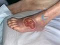 Cou de pied101.jpg