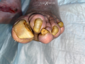 Ongles15.png