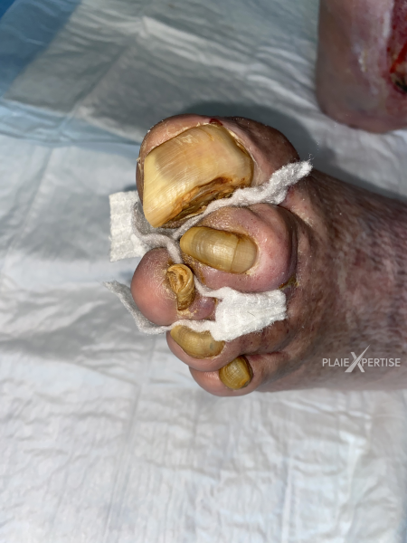 Fichier:Ongles14.png