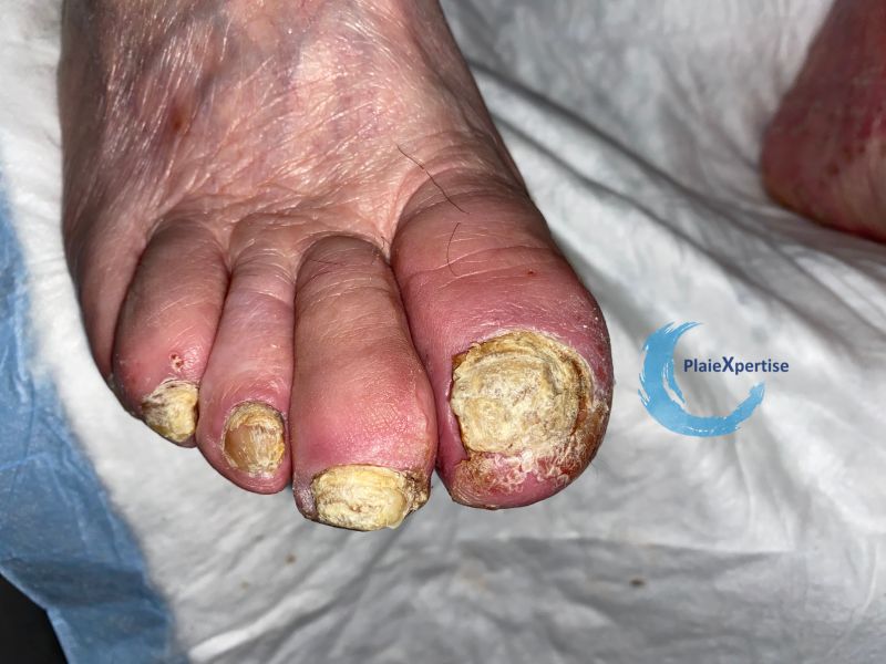 Fichier:Ongles50.jpg