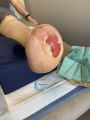 Amputation74.jpg