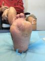 Pied déformé9.jpg