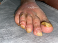 Ongles30.png