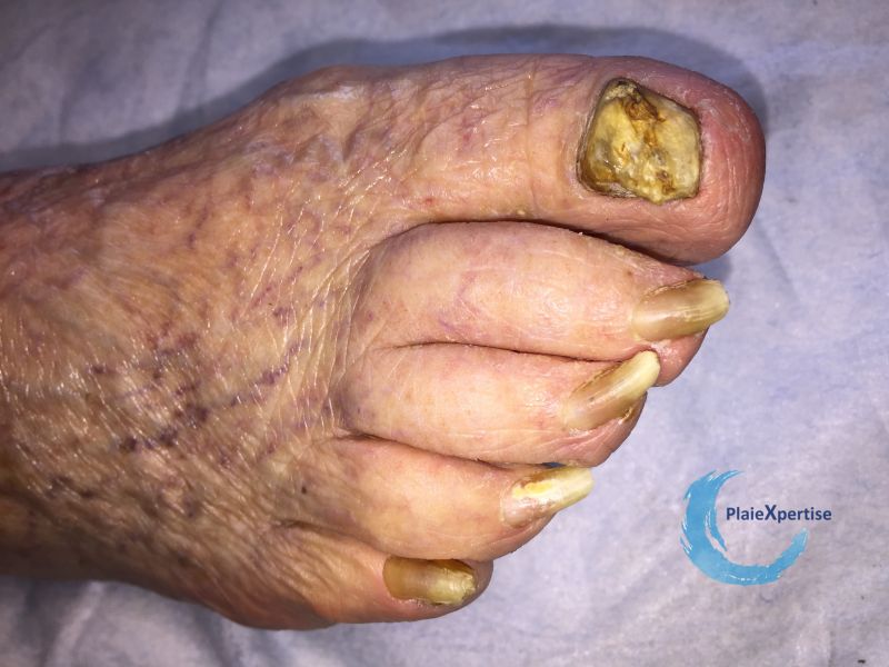 Fichier:Ongles52.jpg